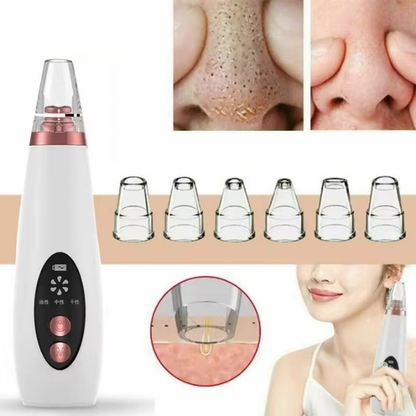 Succionador de poros Deep Clear