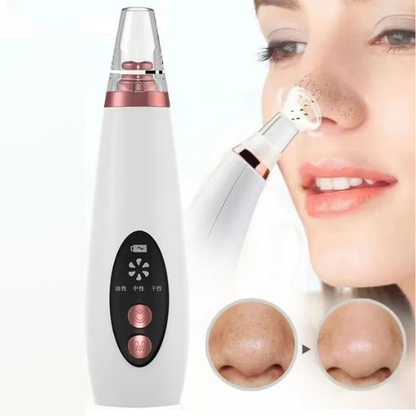 Succionador de poros Deep Clear
